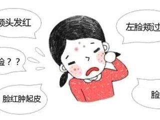 皮肤过敏全身都会发病吗【惠州广肤皮肤病专科医院怎么样】